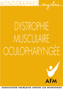 Dystrophie musculaire oculopharyngée