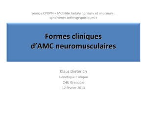 Formes cliniques d`AMC neuromusculaires