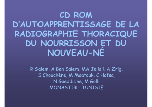 CD ROM D`AUTOAPPRENTISSAGE DE LA RADIOGRAPHIE