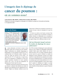 L`imagerie dans le dépistage du cancer du poumon