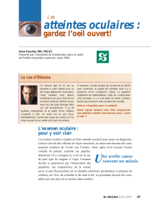 Les atteintes oculaires - STA HealthCare Communications