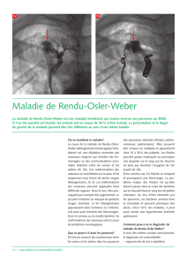 Maladie de Rendu-Osler-Weber