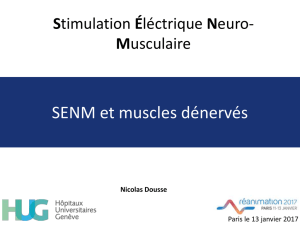 Stimulation Éléctrique Neuro-Musculaire Nicolas_DOUSSE