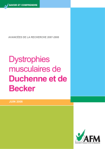 Dystrophies musculaires de Duchenne et de Becker