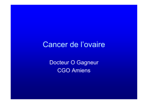 Cancer de l`ovaire - epu