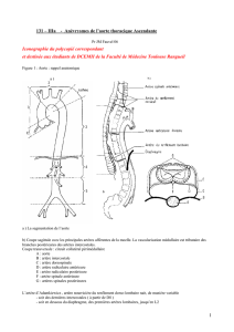 131 – IIIa - Anévrysmes de l`aorte thoracique Ascendante