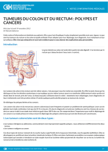 Tumeurs du colon et du rectum : polypes et cancers