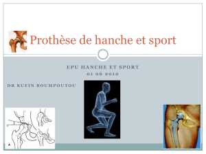Prothèse de hanche et sport