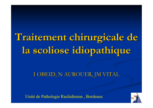 Traitement chirurgicale de la scoliose idiopathique