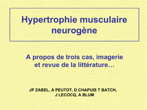 Hypertrophie musculaire neurogène