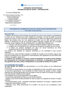 Document d`information LIGAMENTOPLASTIE