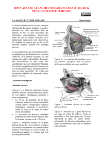 La maxillectomie mediale - Vula