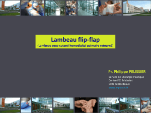 Lambeau flip-flap - e