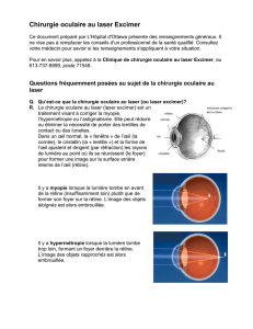 Chirurgie oculaire au laser Excimer