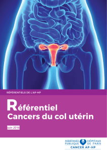referentiel cancers du col uterin