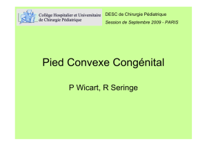 R SERINGE - Pied convexe congénital