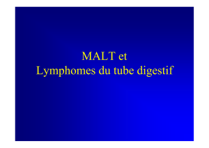 Lymphomes digestifs N Brousse