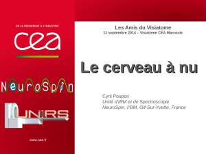 Le cerveau &agrave; nu (Neurospin)