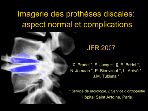 Imagerie des prothèses discales: aspect normal et complications