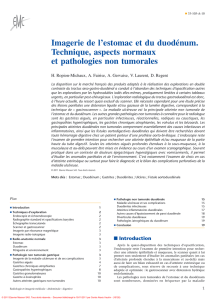 Imagerie de l`estomac et du duodénum. Technique