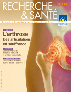 L`arthrose