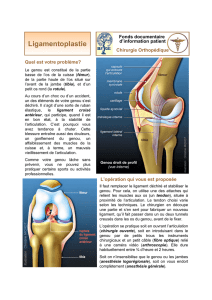 Ligamentoplastie - Groupe Chirurgical Thiers