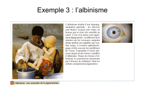 Exemple 3 : l`albinisme