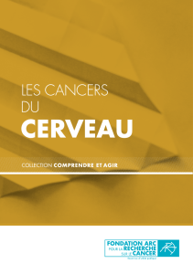 Les cancers du cerveau