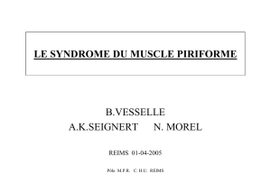 LE SYNDROME DU MUSCLE PIRIFORME B.VESSELLE A.K.