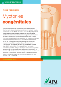 Les myotonies congénitales