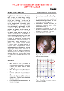 Subtotal petrosectomy - Vula