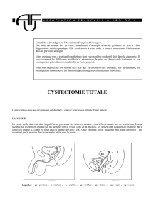 cystectomie totale