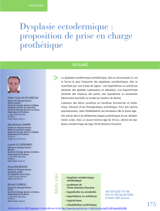 Dysplasie ectodermique : proposition de prise en charge prothétique