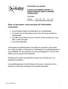 À quoi s`attendre pendant la radiothérapie dans la région thoracique