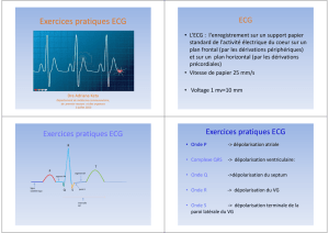 Exercices pratiques ECG