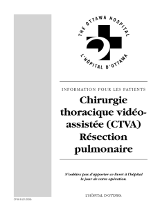 Chirurgie thoracique vidéo-assistée