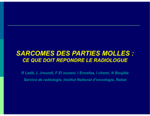 SARCOMES DES PARTIES MOLLES :