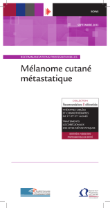 mélanome cutané métastatique - Institut National Du Cancer