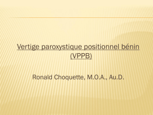 Vertige paroxystique positionnel bénin (VPPB) (présentation