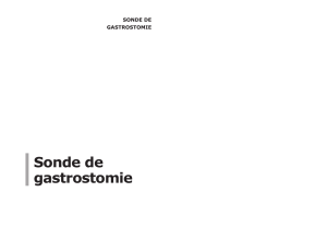 Sonde de gastrostomie