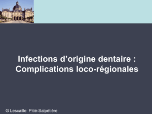 Infections d`origine dentaire : Complications loco