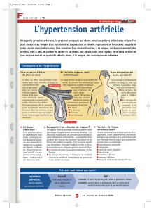 L`hypertension artérielle