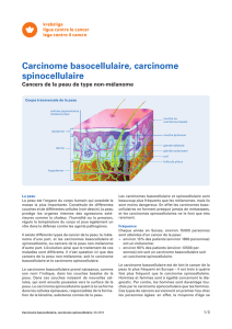 Carcinome basocellulaire, carcinome spinocellulaire