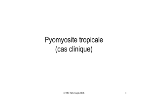 Pyomyosite tropicale (cas clinique)