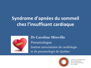SAS et insuffisance cardiaque – Dre Caroline Minville