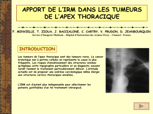APPORT DE L`IRM DANS LES TUMEURS DE L`APEX THORACIQUE