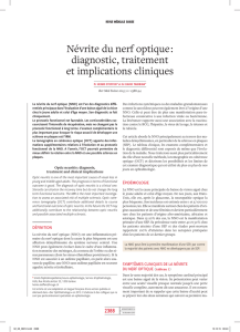 Névrite du nerf optique : diagnostic, traitement et implications cliniques