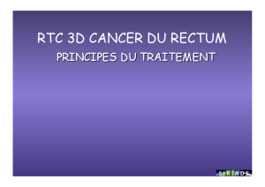 rtc 3d cancer du rectum