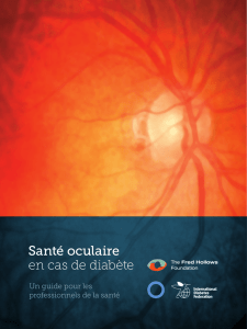 Santé oculaire en cas de diabète - International Diabetes Federation