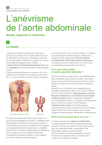 L`anévrisme de l`aorte abdominale - Centre Cardio